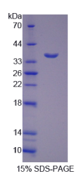 含Kazal型丝氨酸蛋白酶抑制剂域蛋白1(KAZALD1)重组蛋白
