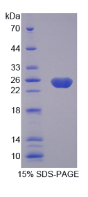 胱天蛋白酶8(CASP8)重组蛋白