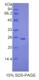 桥粒芯胶粘蛋白1(DSC1)重组蛋白