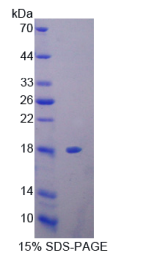 抑丝蛋白3(PFN3)重组蛋白