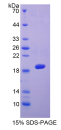 血小板反应蛋白解整合素金属肽酶5(ADAMTS5)重组蛋白