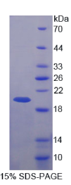 含BRCA1/BRCA2复合体3亚基(BRCC3)重组蛋白