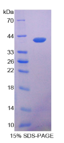 角蛋白14(KRT14)重组蛋白