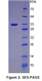 角蛋白5(KRT5)重组蛋白