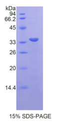 信号传导转录激活因子6(STAT6)重组蛋白