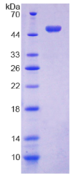胎盘蛋白13(PP13)重组蛋白