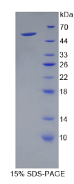 激肽释放酶4(KLK4)重组蛋白