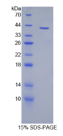 巨噬细胞炎性蛋白3α(MIP3α)重组蛋白