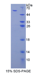 血小板反应蛋白3(THBS3)重组蛋白
