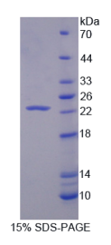 肝配蛋白A1(EFNA1)重组蛋白