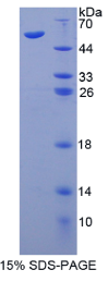 免疫球蛋白超家族成员16(IGSF16)重组蛋白