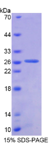 原始广泛存在蛋白1(AUP1)重组蛋白