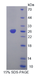 烟碱型胆碱受体α4(CHRNα4)重组蛋白