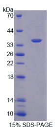 同线蛋白1(ST1)重组蛋白
