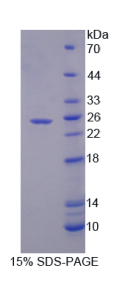 分泌型卷曲相关蛋白2(SFRP2)重组蛋白