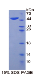 角蛋白20(KRT20)重组蛋白