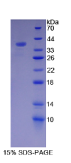 辅肌动蛋白α4(ACTN4)重组蛋白