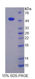 激肽原1(KNG1)重组蛋白
