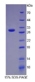 细胞程序性死亡蛋白1配体1(PDCD1LG1)重组蛋白