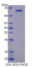 激活STAT蛋白抑制因子3(PIAS3)重组蛋白