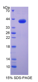 巨噬细胞炎性蛋白1α(MIP1α)重组蛋白