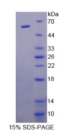 细胞粘附分子1(CADM1)重组蛋白