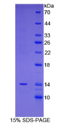 序列相似家族19成员A2(FAM19A2)重组蛋白