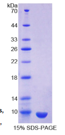 克拉拉细胞蛋白16(CC16)重组蛋白