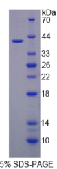 铁反应元件结合蛋白2(IREB2)重组蛋白