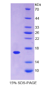 膜联蛋白A3(ANXA3)重组蛋白