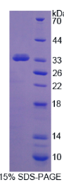 原钙黏素15(PCDH15)重组蛋白