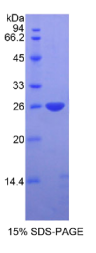 含DIX域蛋白1(DIXDC1)重组蛋白