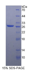 脊髓灰质炎病毒受体相关分子3(PVRL3)重组蛋白