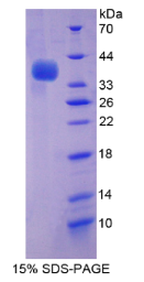 衔接因子相关蛋白复合体2μ1(AP2μ1)重组蛋白