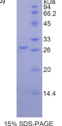 谷胱甘肽S转移酶μ2(GSTμ2)重组蛋白