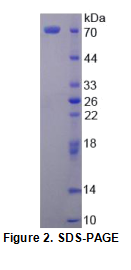 分泌粒蛋白Ⅱ(SCG2)重组蛋白