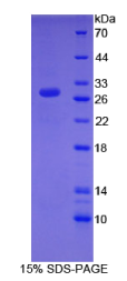 染色质域解旋酶DNA结合蛋白3(CHD3)重组蛋白