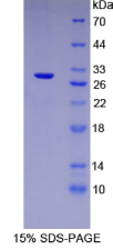 微管蛋白β6(TUBβ6)重组蛋白