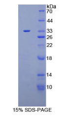 含普列克底物同源物域家族A成员1(PLEKHA1)重组蛋白