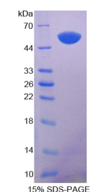 角蛋白14(KRT14)重组蛋白