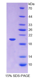 胰岛素样生长因子结合蛋白2(IGFBP2)重组蛋白
