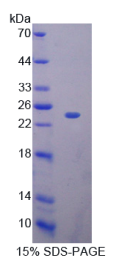 糖核酸酶A11(RNASE11)重组蛋白