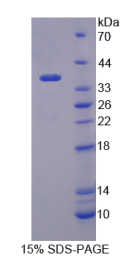 含MOCO硫化酶羧基端域蛋白1(MOSC1)重组蛋白