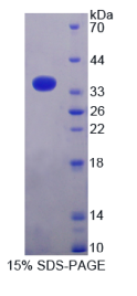 微管蛋白β1(TUBβ1)重组蛋白