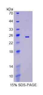 肝配蛋白A5(EFNA5)重组蛋白