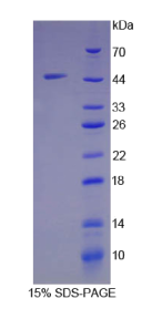 核糖核酸酶A(RNASE1)重组蛋白