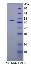 核纤层蛋白B1(LMNB1)重组蛋白