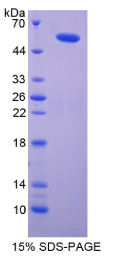 输入蛋白8(IPO8)重组蛋白
