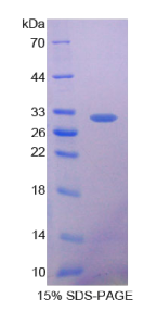 谷胱甘肽S转移酶θ1(GSTθ1)重组蛋白