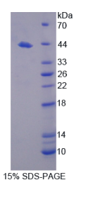 铜离子转运ATP酶β肽(ATP7β)重组蛋白